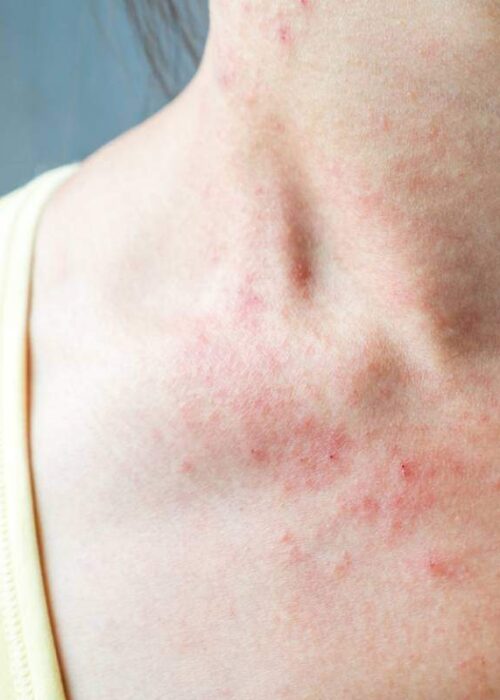 media-les-box-par-abonnement-pour-apaiser-les-peaux-eczemateuses